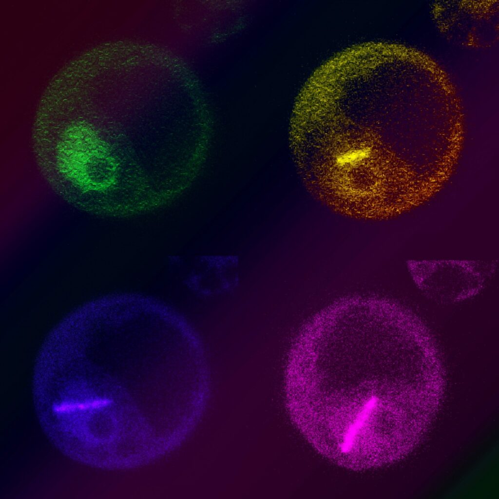 Rostlinné buňky s opravnými proteiny vážícími se na laserem poškozenou DNA Foto ÚEB AV ČR
